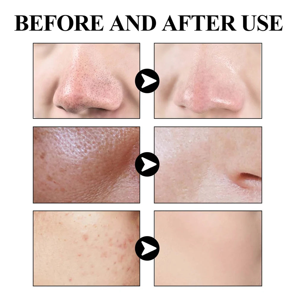 West Month Blackhead Mud Mask Oil Control Pore Care