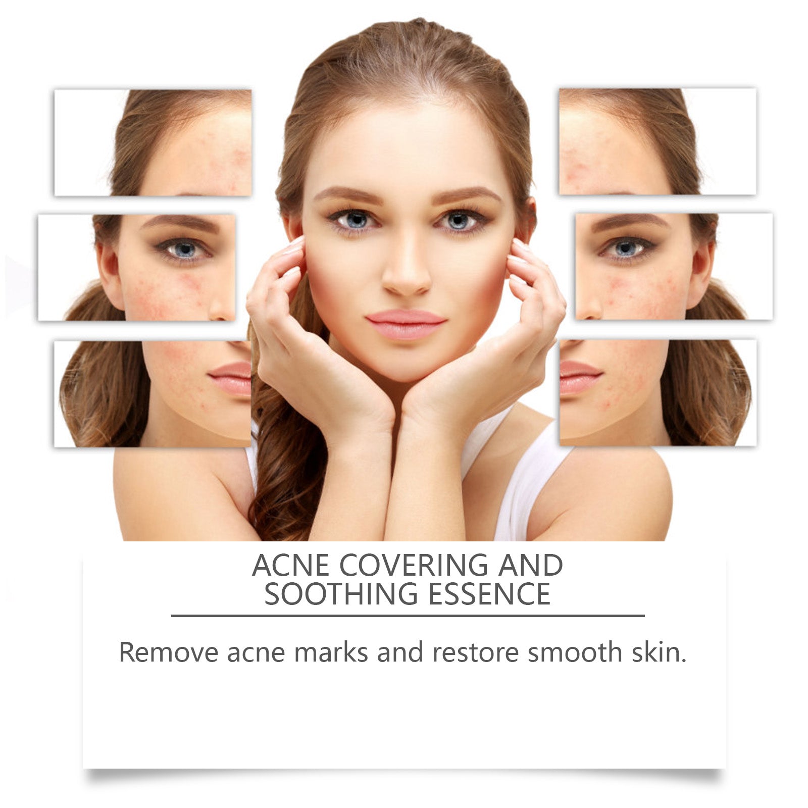 Acne Soothing Serum Hydrating Moisturizing Pimple Care Facial Solution