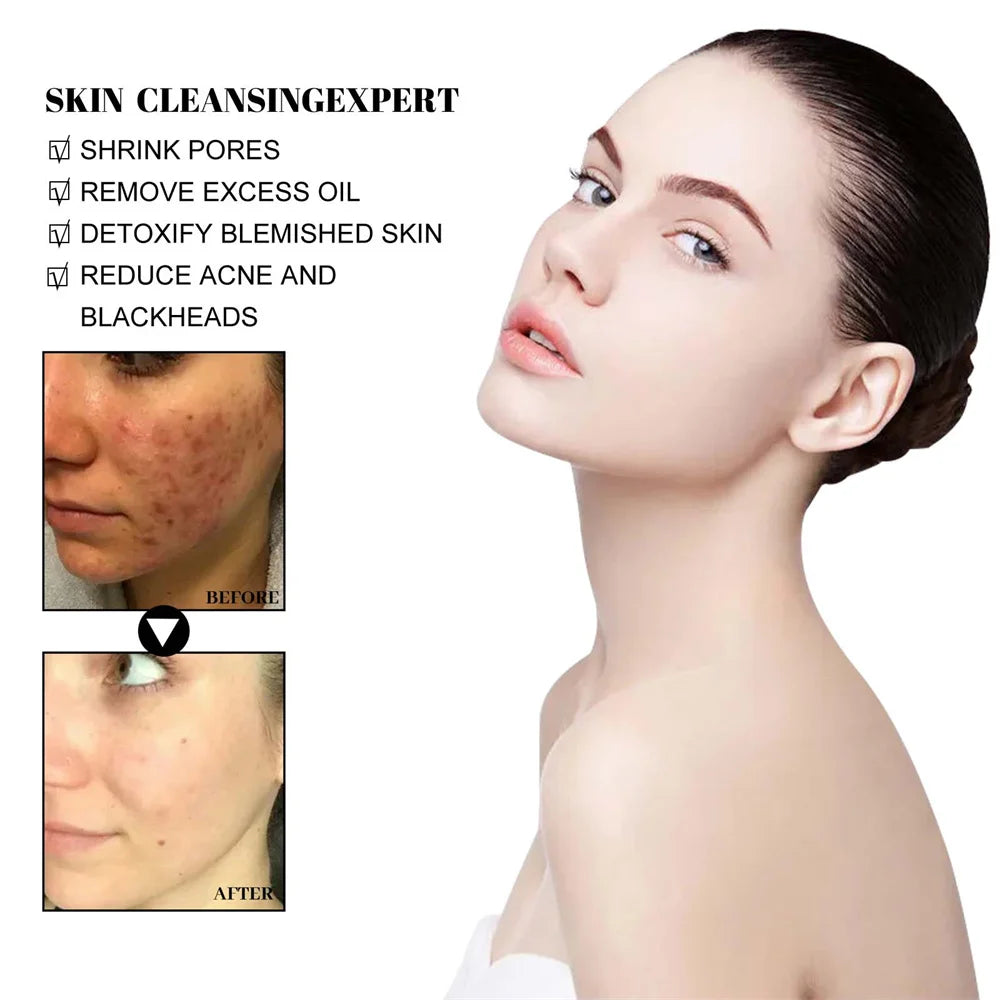 West Month Blackhead Mud Mask Oil Control Pore Care